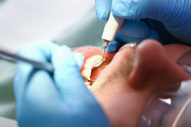 Best Emergency Broken Tooth Repair in Calhoun, GA