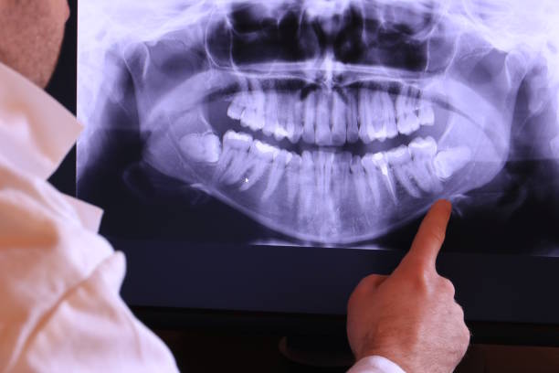 Trusted GA Emergency Dentist Experts