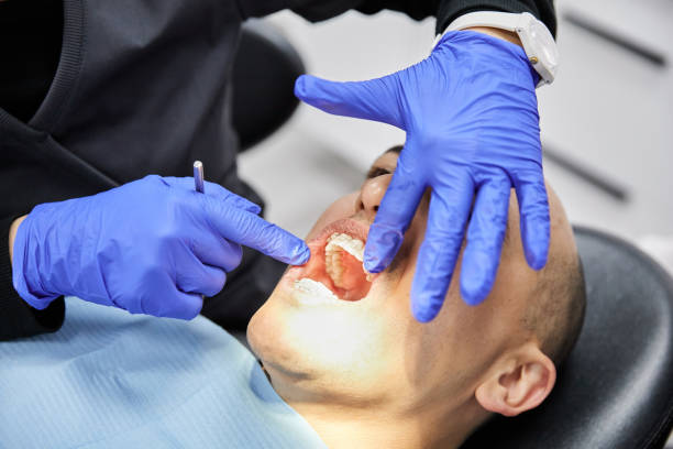 Best Emergency Tooth Extraction in Calhoun, GA
